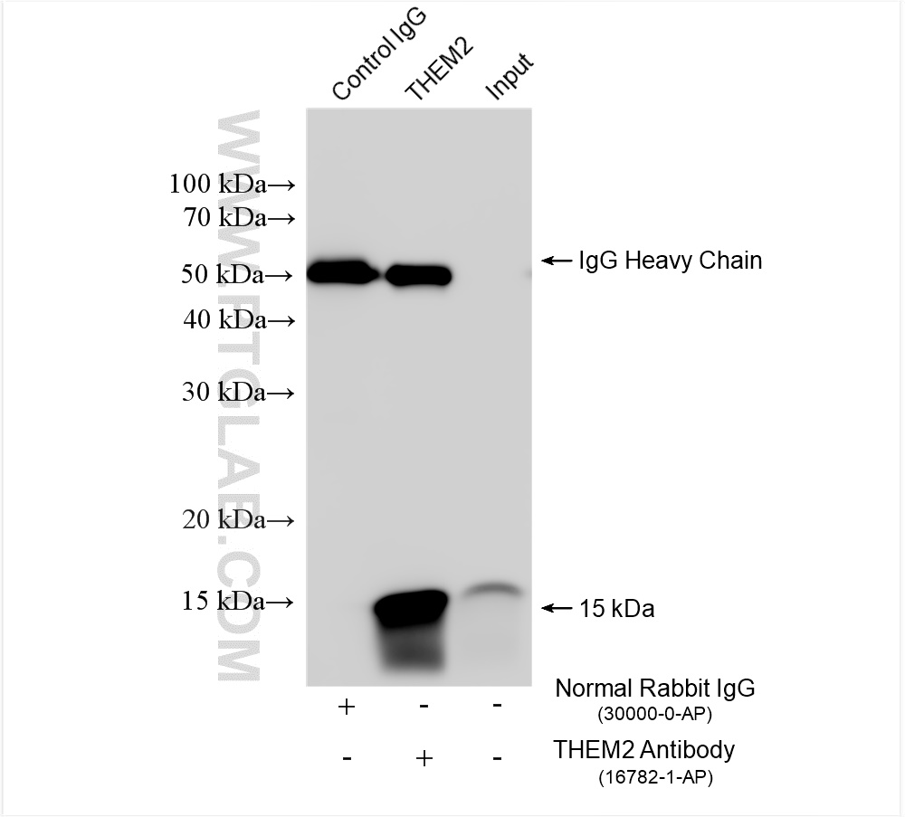 IP experiment of HeLa using 16782-1-AP