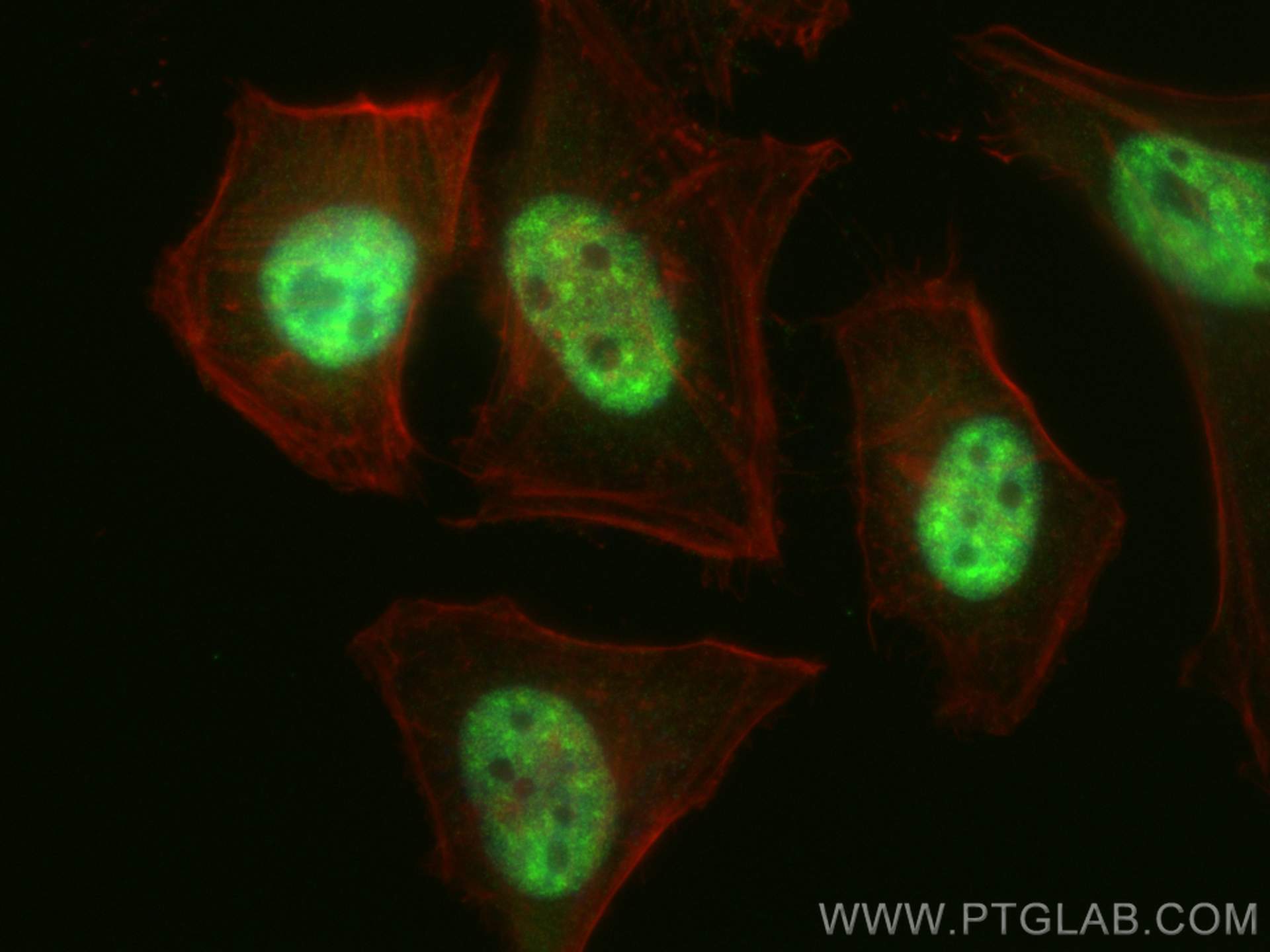 IF Staining of HeLa using 55178-1-AP