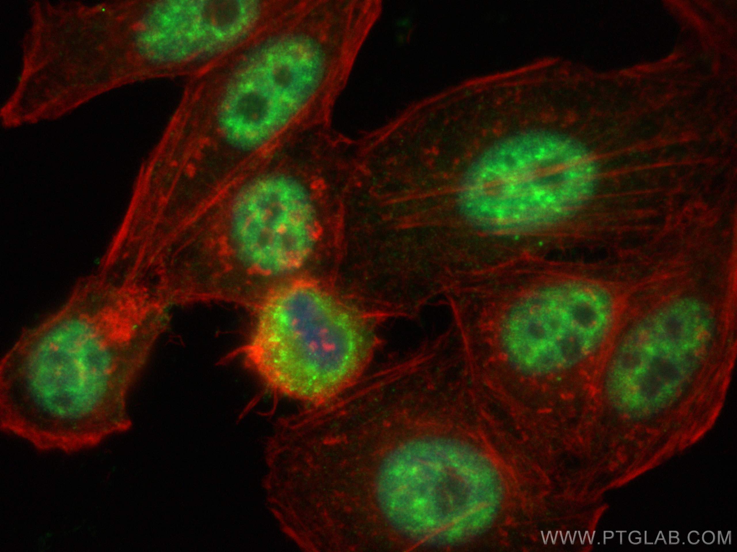 IF Staining of HepG2 using 14862-1-AP