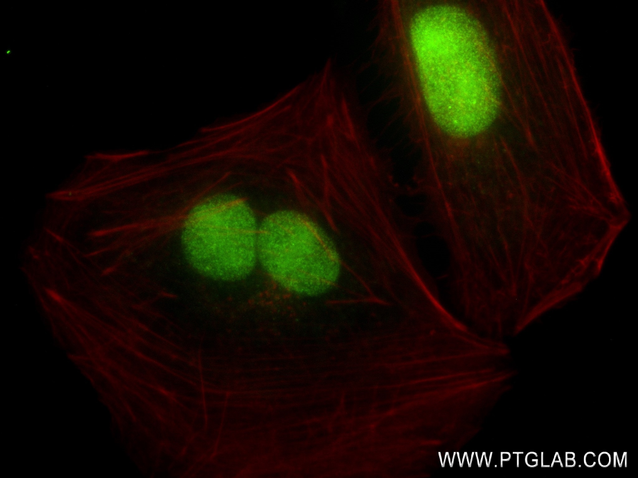 IF Staining of U2OS using 83435-1-RR (same clone as 83435-1-PBS)