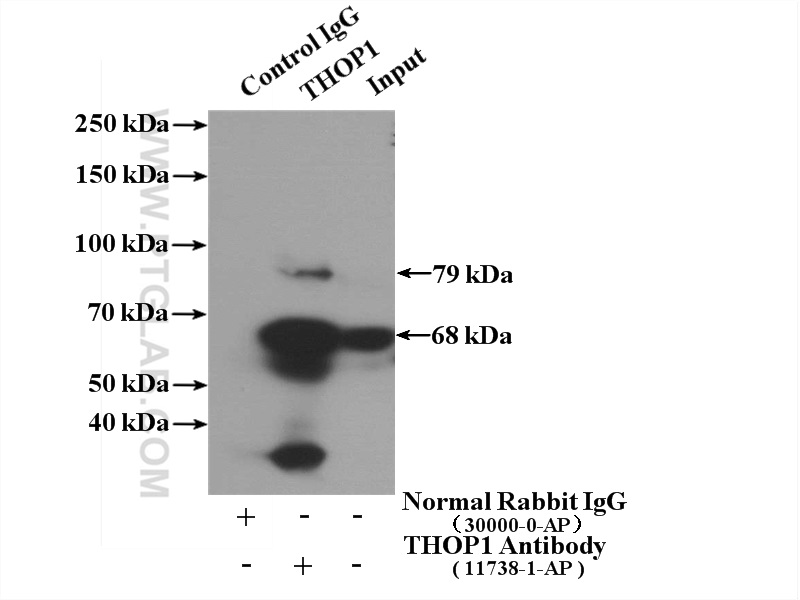 IP experiment of human placenta using 11738-1-AP