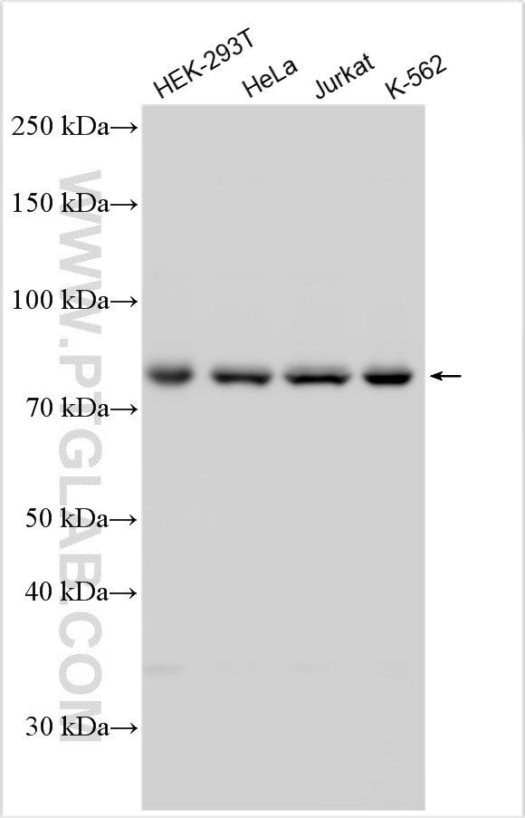 WB analysis using 11738-1-AP