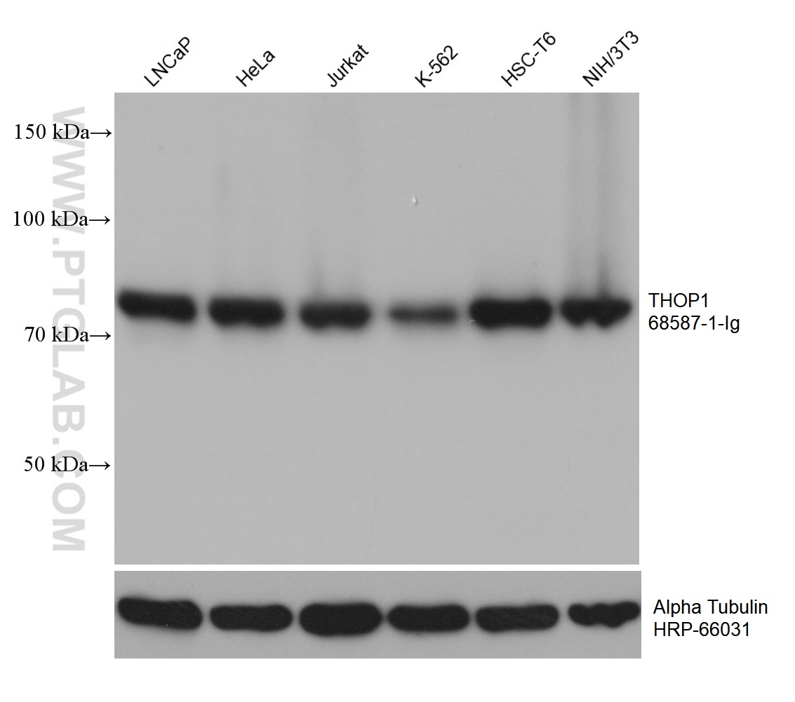 WB analysis using 68587-1-Ig (same clone as 68587-1-PBS)