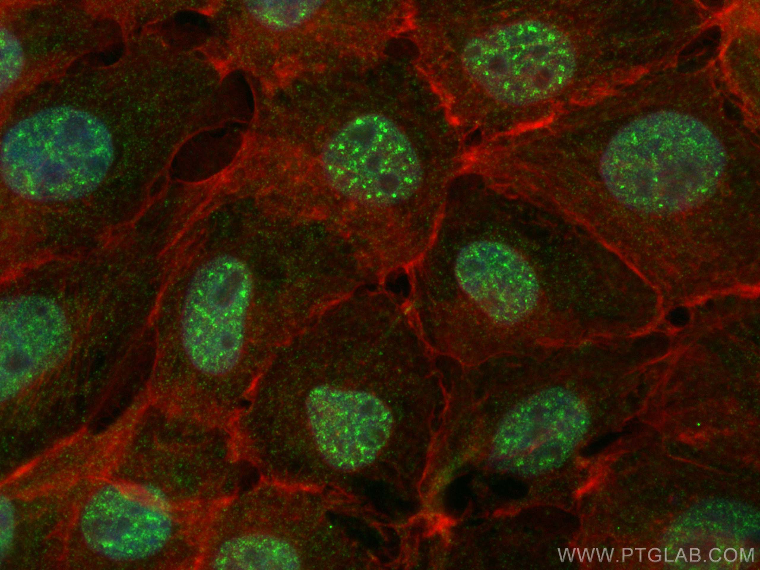 IF Staining of A431 using 66703-1-Ig