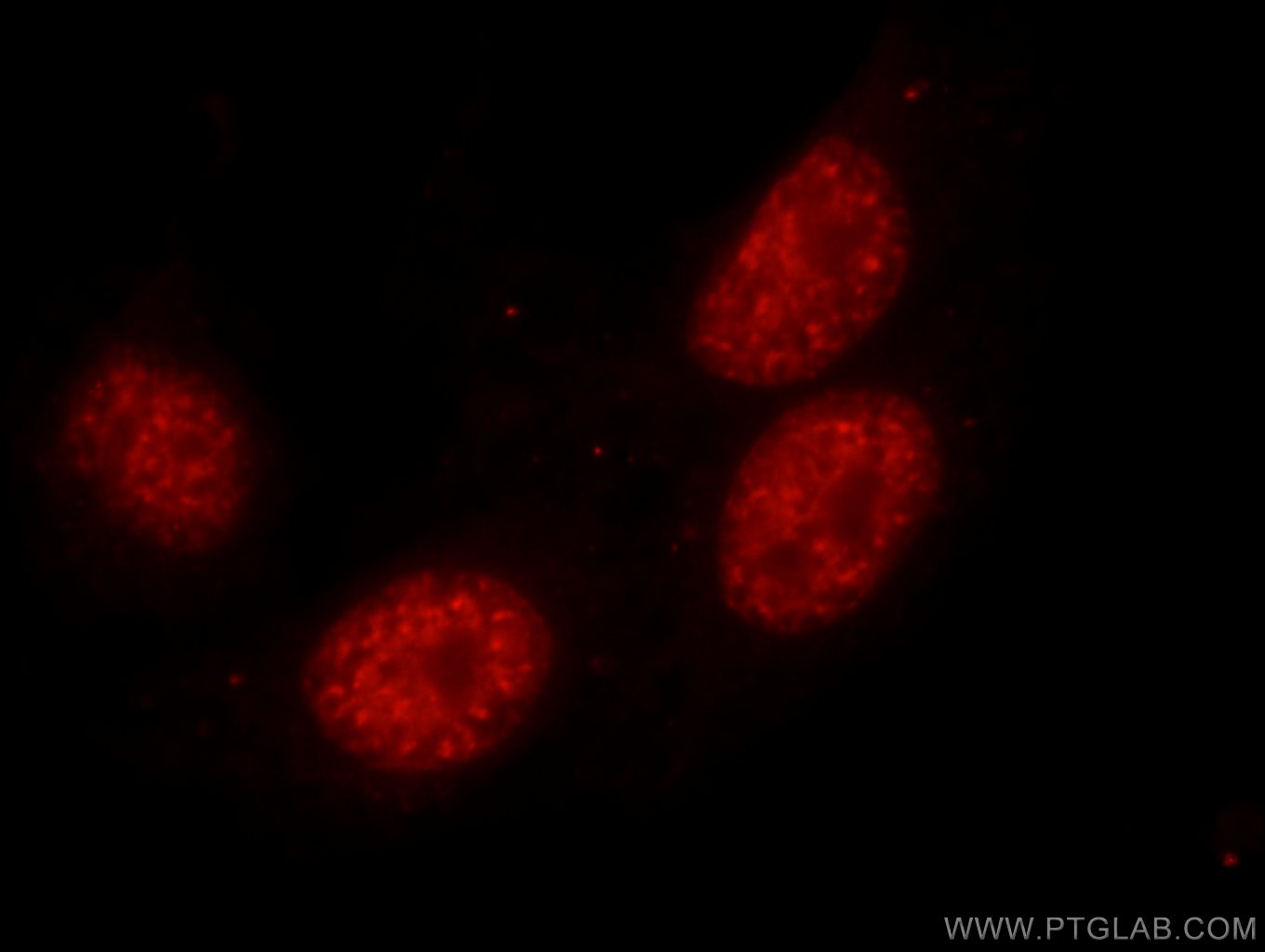 IF Staining of HepG2 using 19744-1-AP