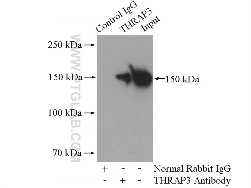 IP experiment of HeLa using 19744-1-AP