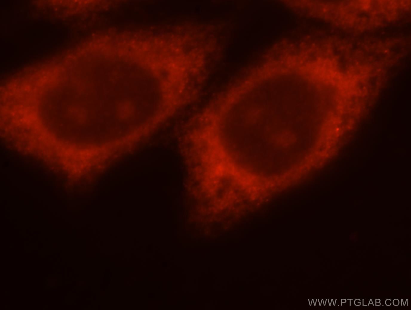 IF Staining of HepG2 using 15486-1-AP