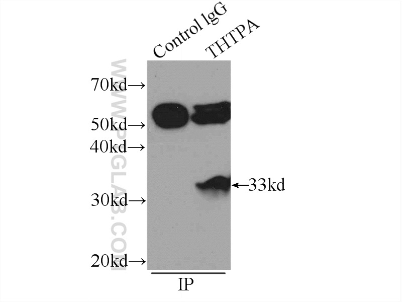 IP experiment of K-562 using 15486-1-AP