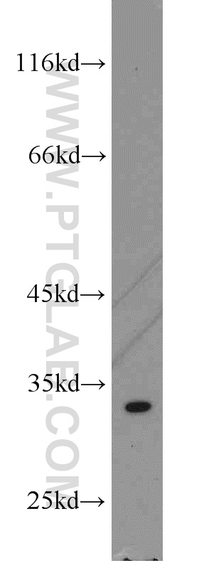 WB analysis of K-562 using 15486-1-AP