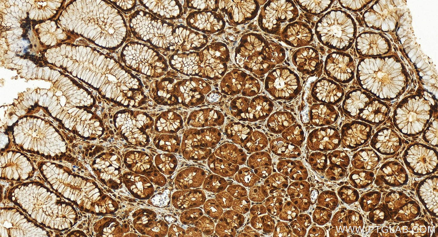 IHC staining of human stomach using 17649-1-AP