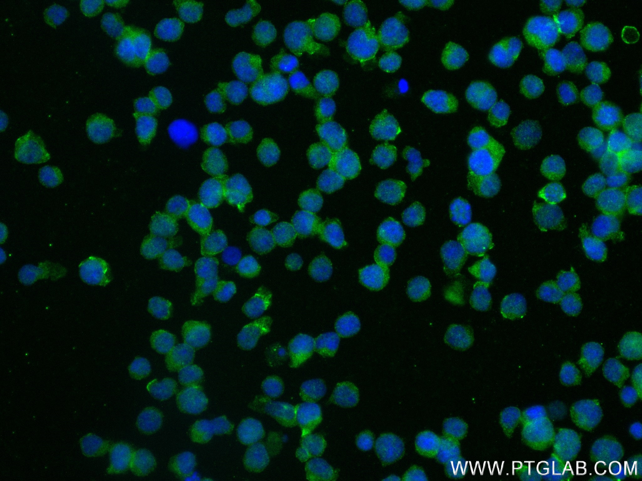 IF Staining of Jurkat using 83545-1-RR (same clone as 83545-1-PBS)