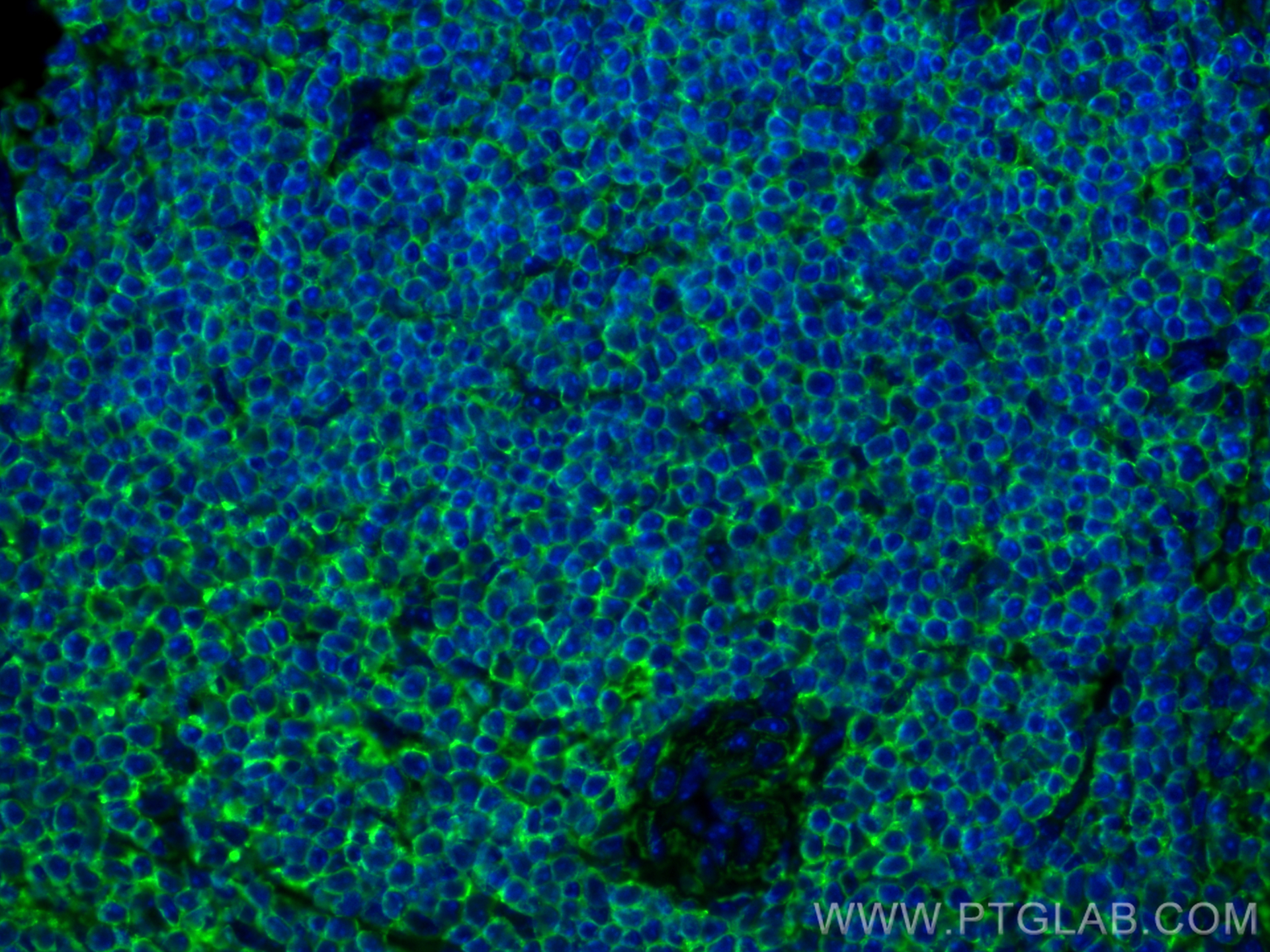 IF Staining of mouse spleen using 83545-1-RR (same clone as 83545-1-PBS)