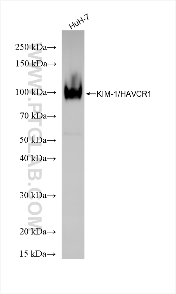 TIM-1