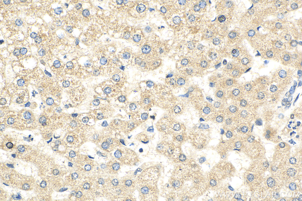 IHC staining of human liver using 13859-1-AP