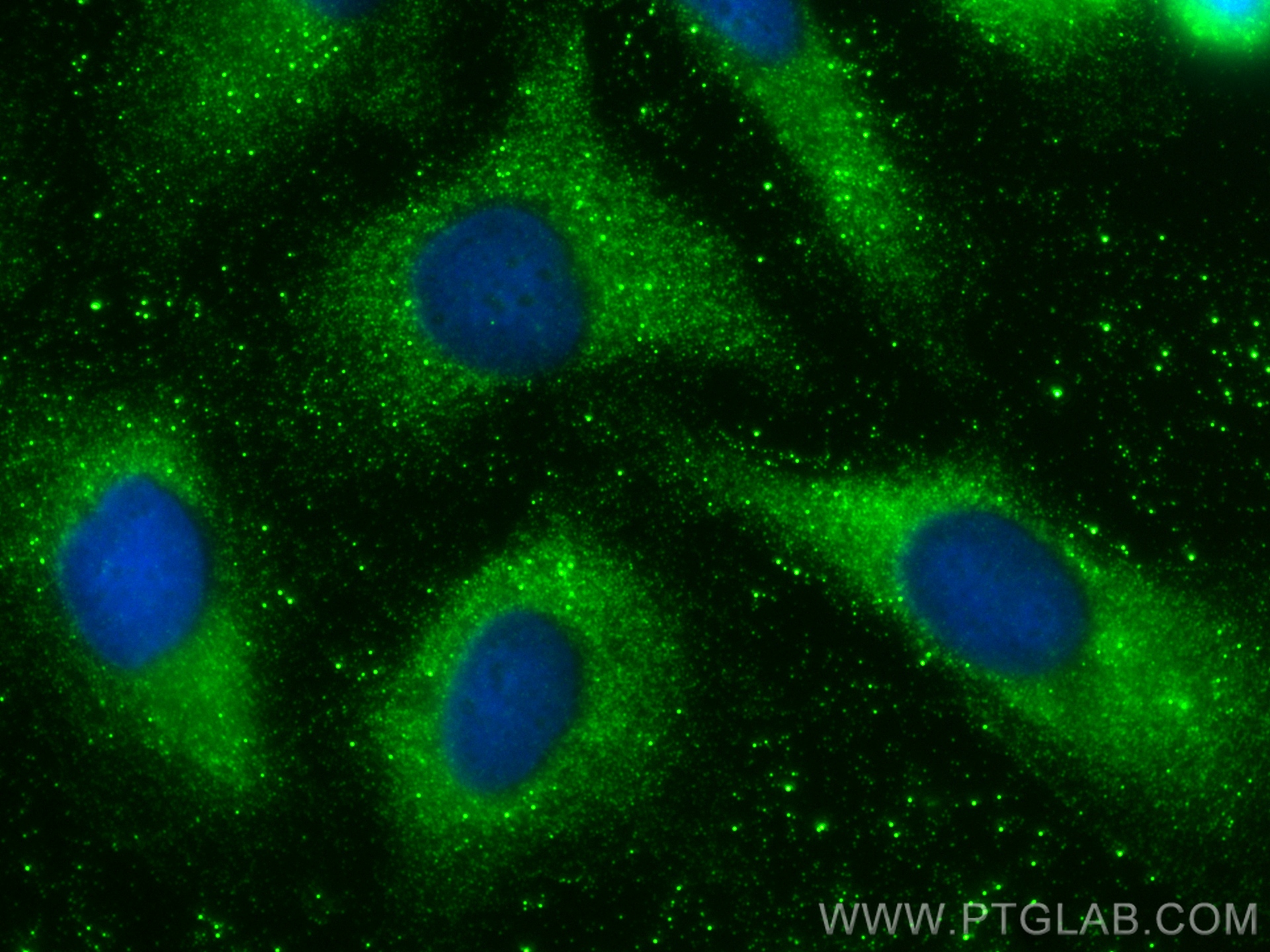 IF Staining of SKOV-3 using 26847-1-AP