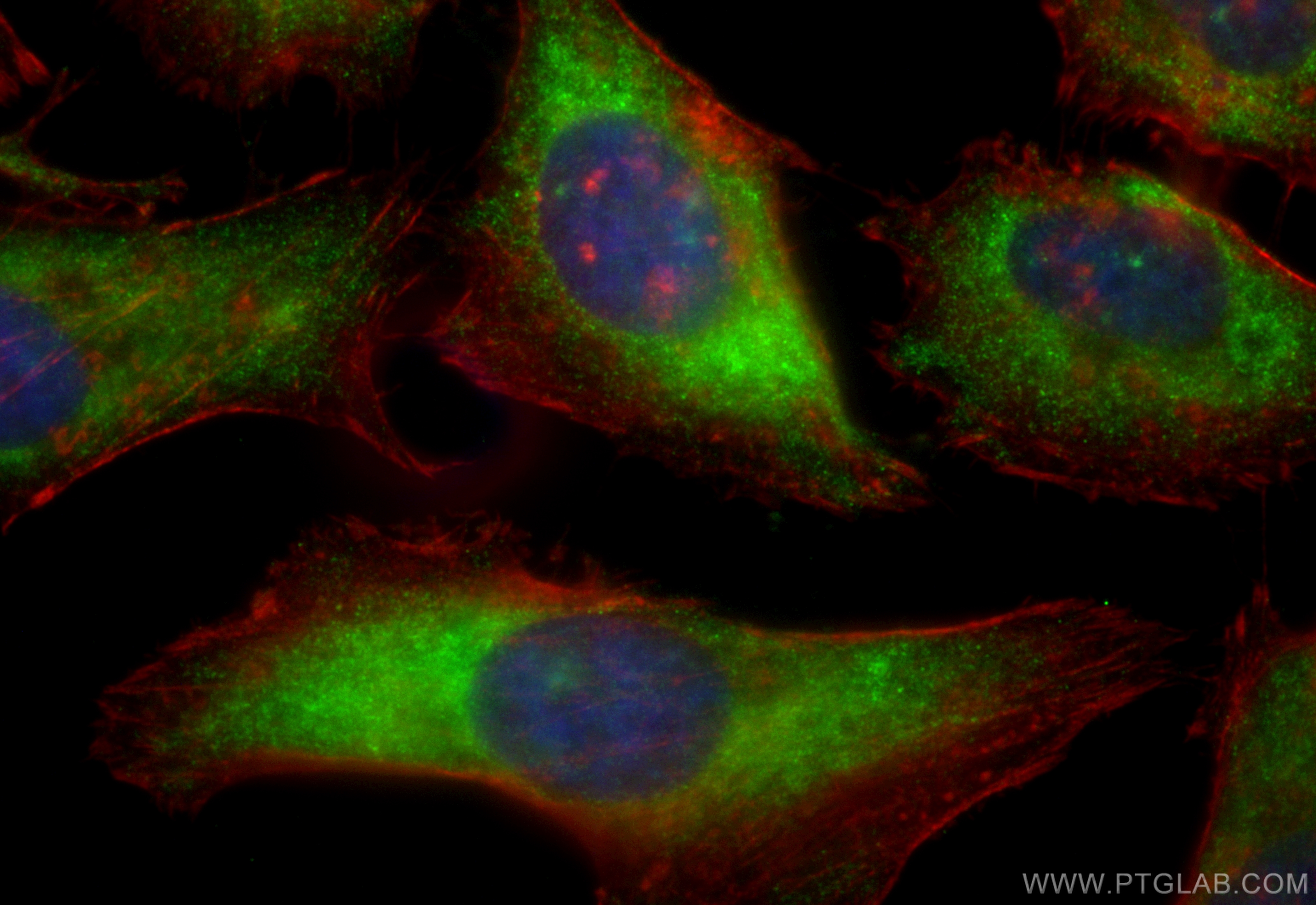 IF Staining of HeLa using CL488-83151-5