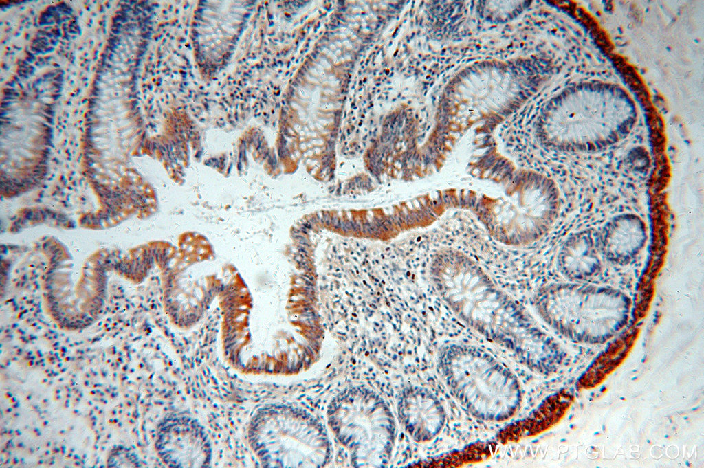 IHC staining of human colon using 19747-1-AP