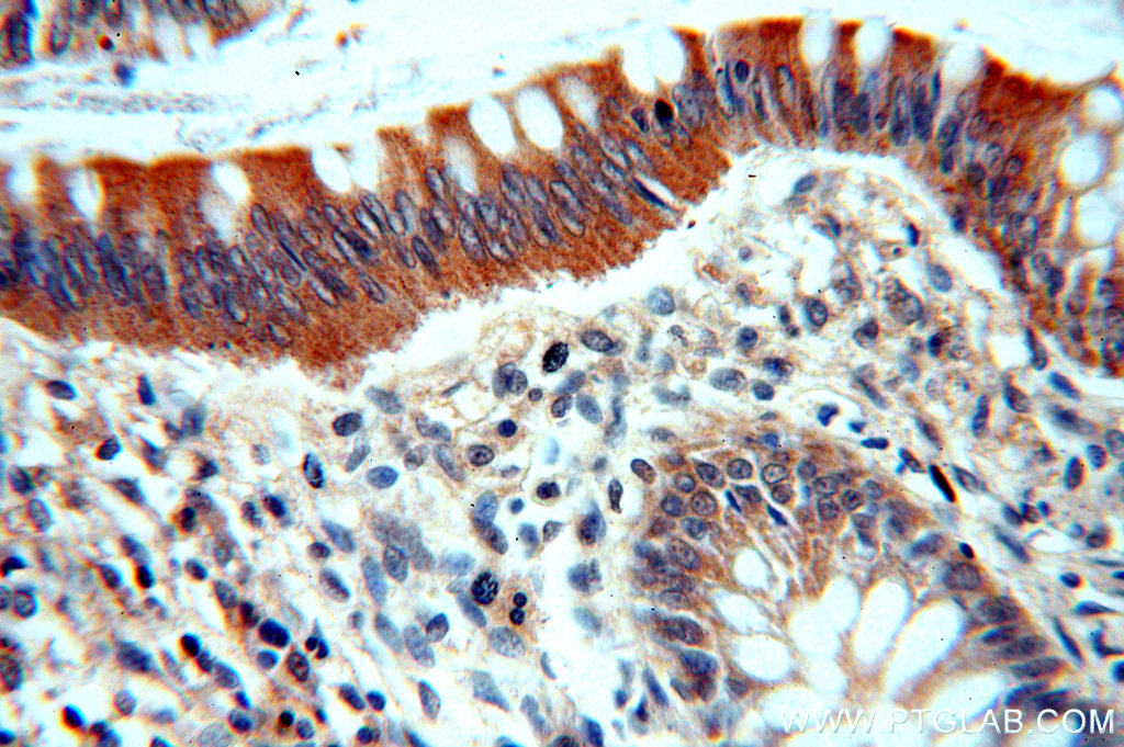 IHC staining of human colon using 19747-1-AP