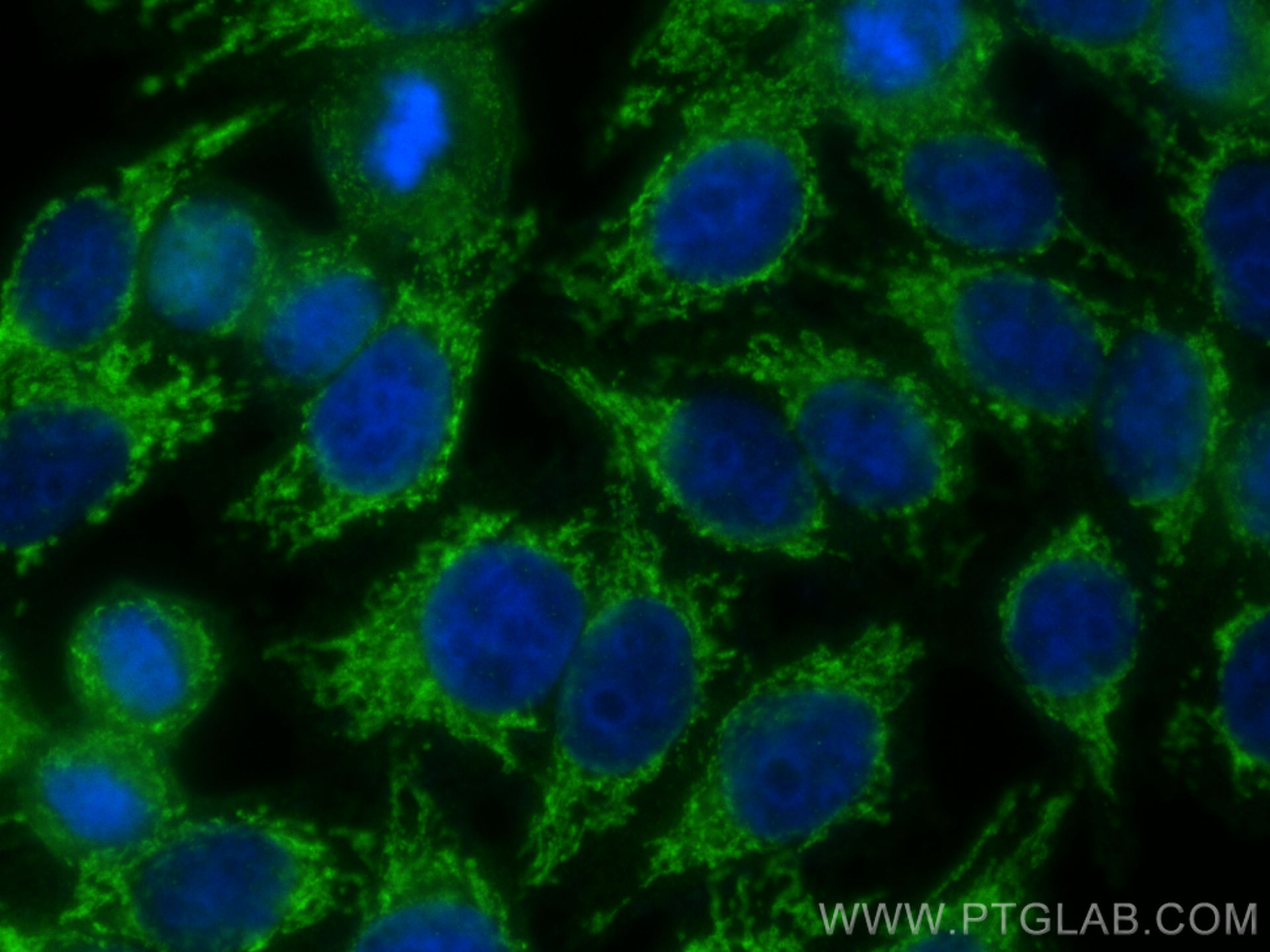 IF Staining of HepG2 using 12077-1-AP (same clone as 12077-1-PBS)