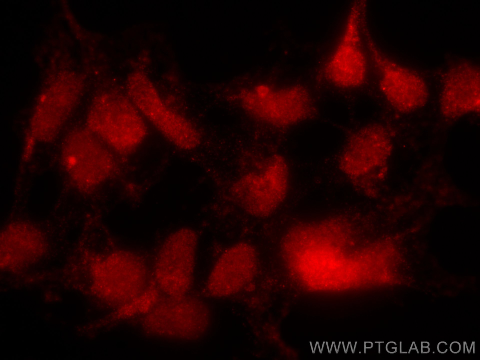 IF Staining of HEK-293 using CL594-66374