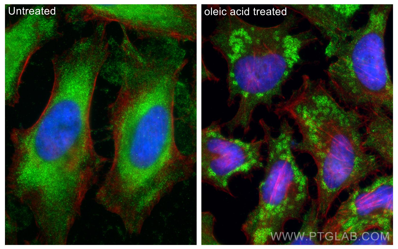 IF Staining of HeLa using 66523-1-Ig