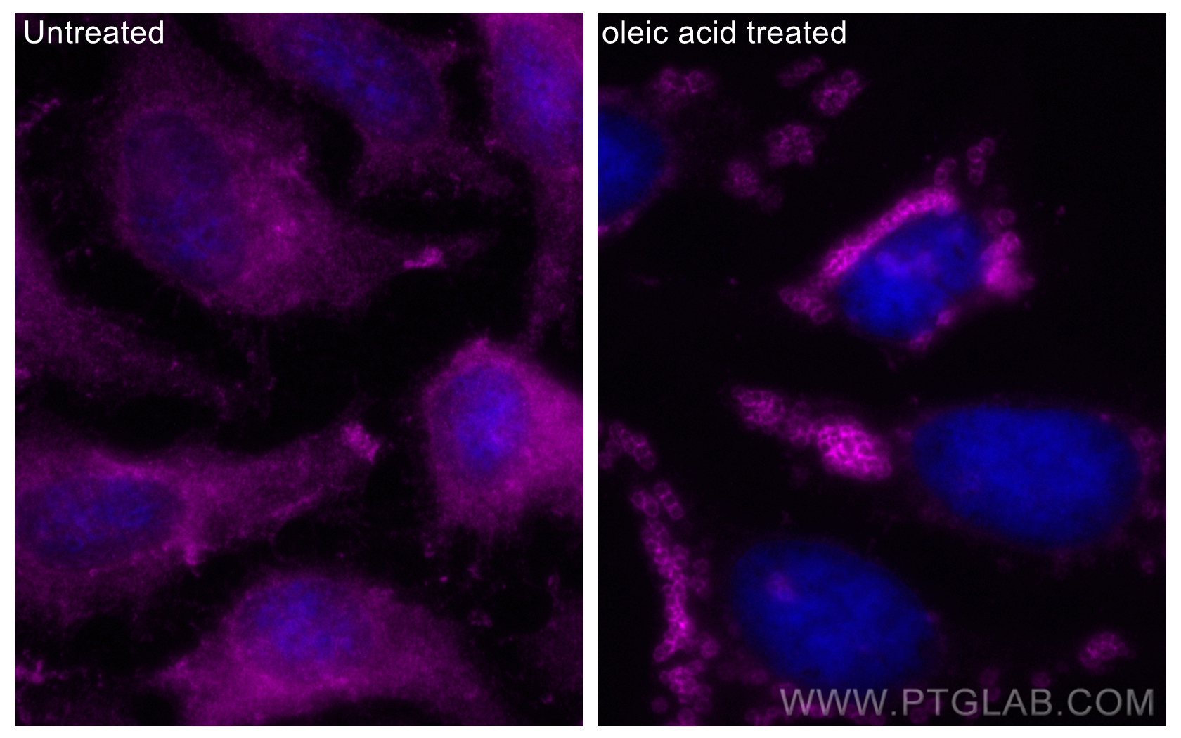 IF Staining of HeLa using CL647-10694