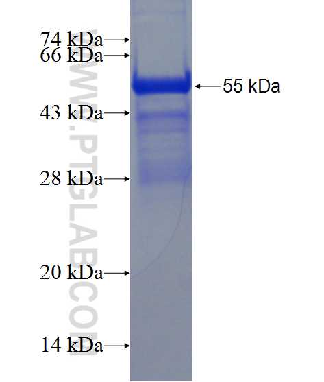 TJAP1 fusion protein Ag11807 SDS-PAGE