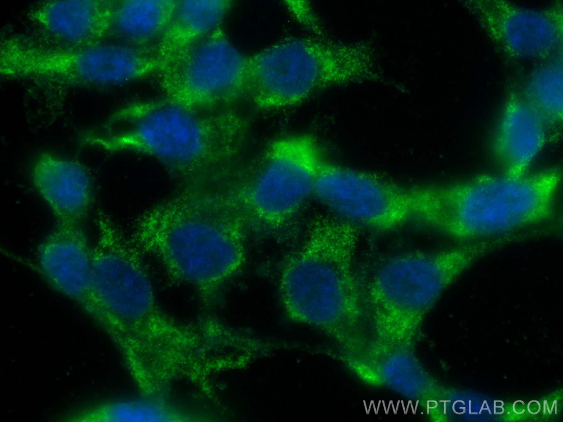 IF Staining of HCT 116 using 67787-1-Ig