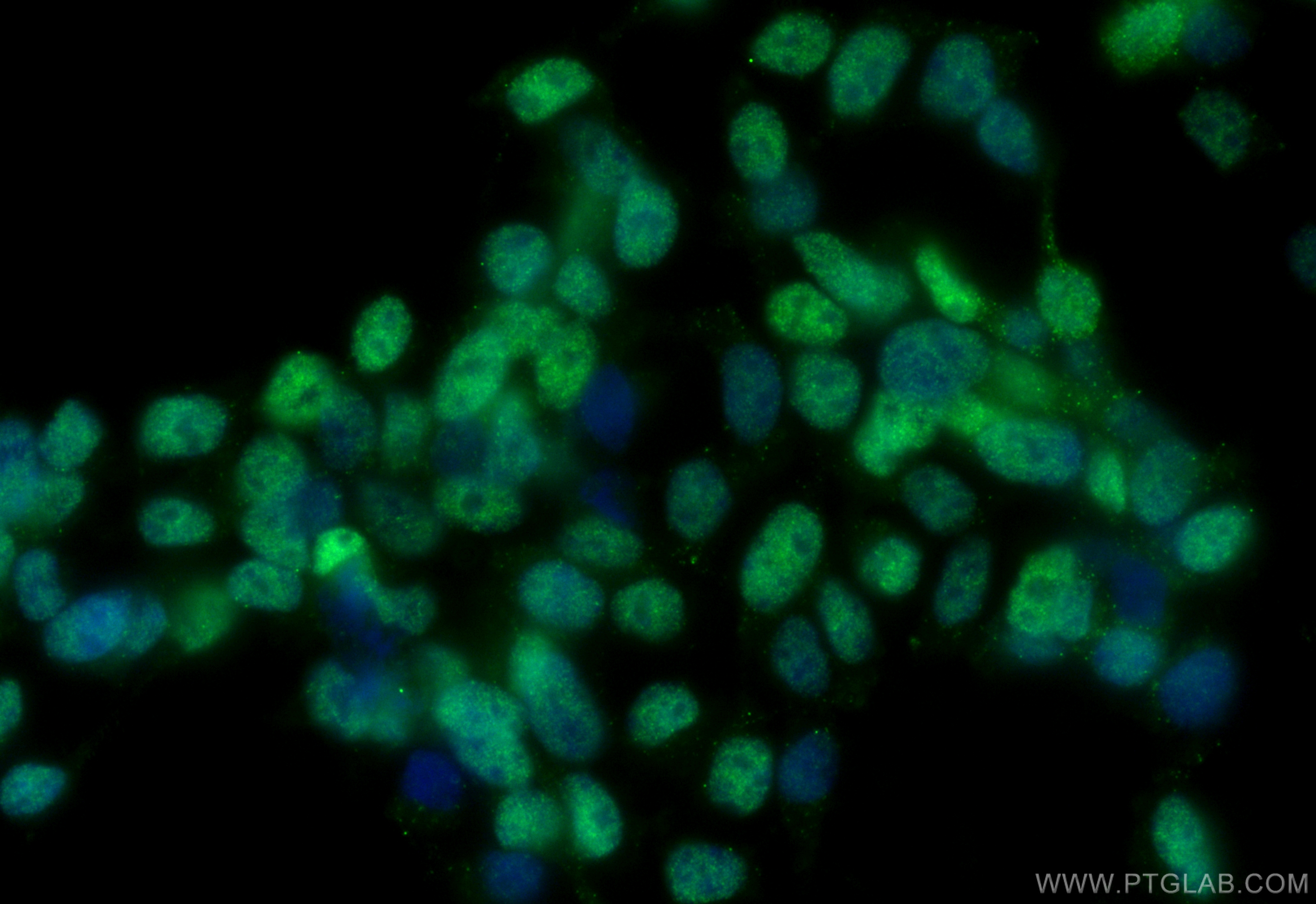 IF Staining of SH-SY5Y using 66216-1-Ig