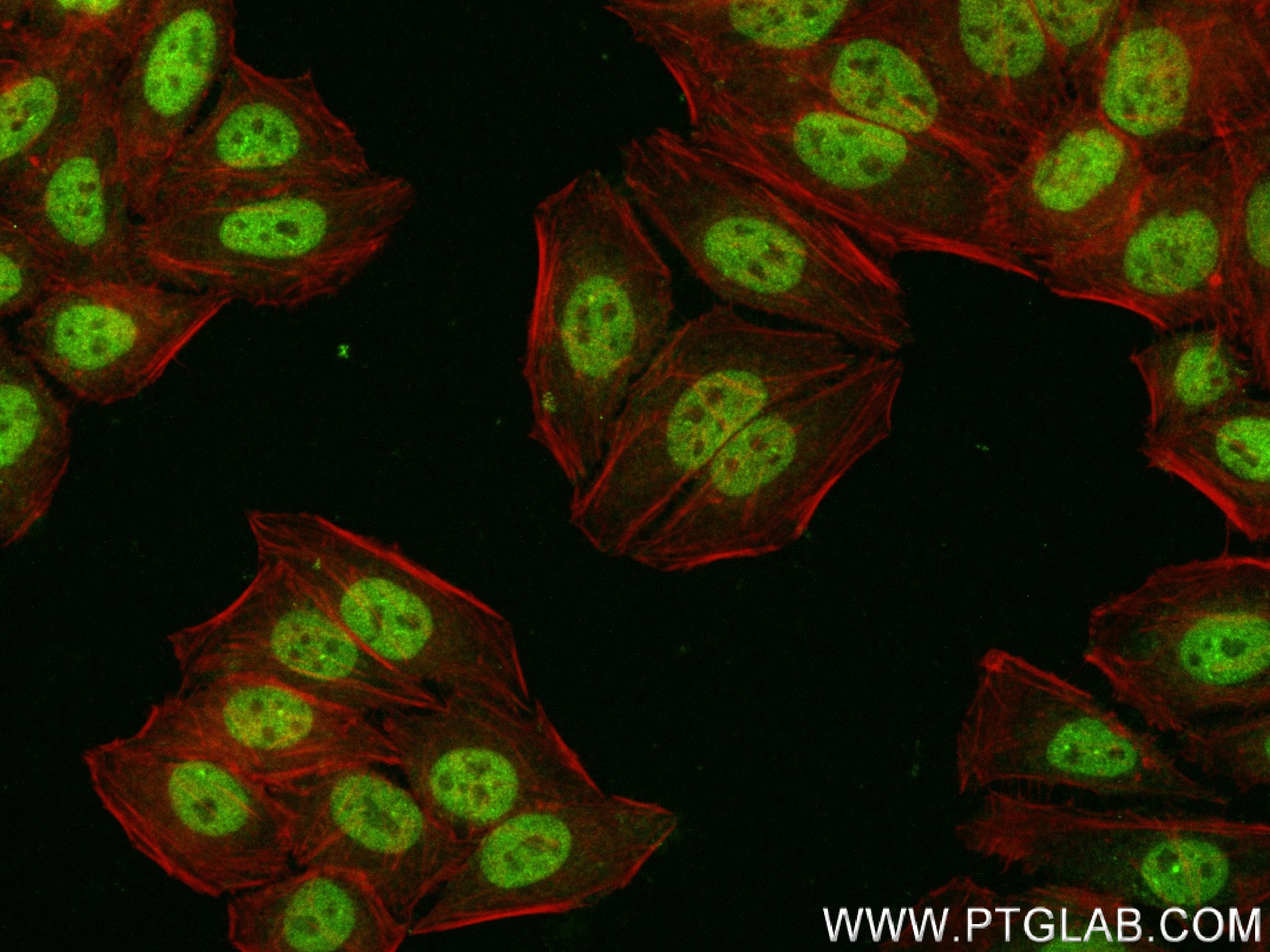 IF Staining of HepG2 using 83955-4-RR (same clone as 83955-4-PBS)