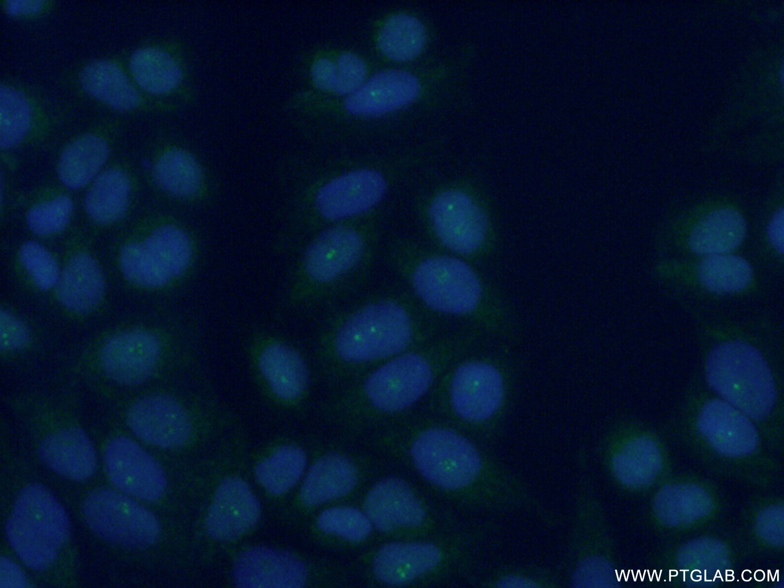 IF Staining of HeLa using 13564-1-AP