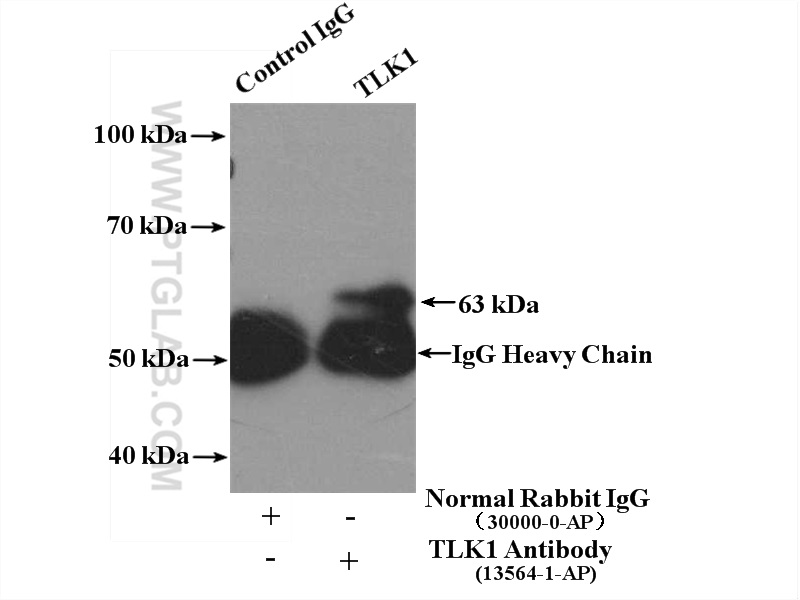 IP experiment of HeLa using 13564-1-AP