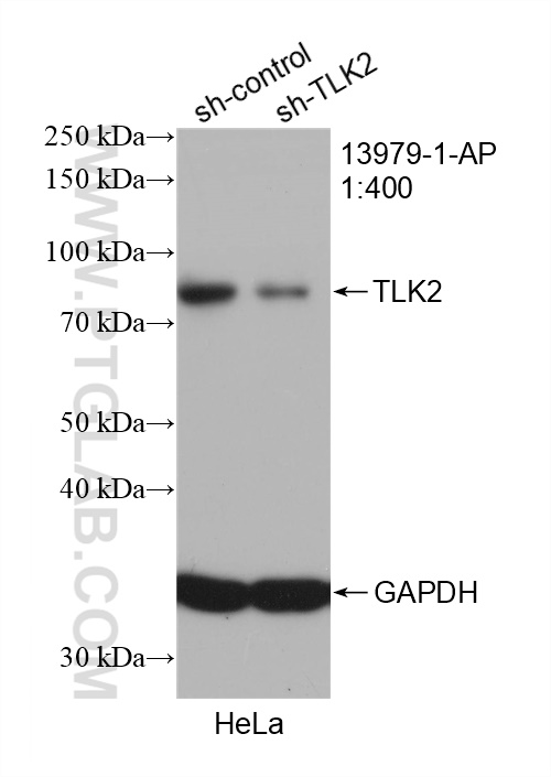 WB analysis of HeLa using 13979-1-AP