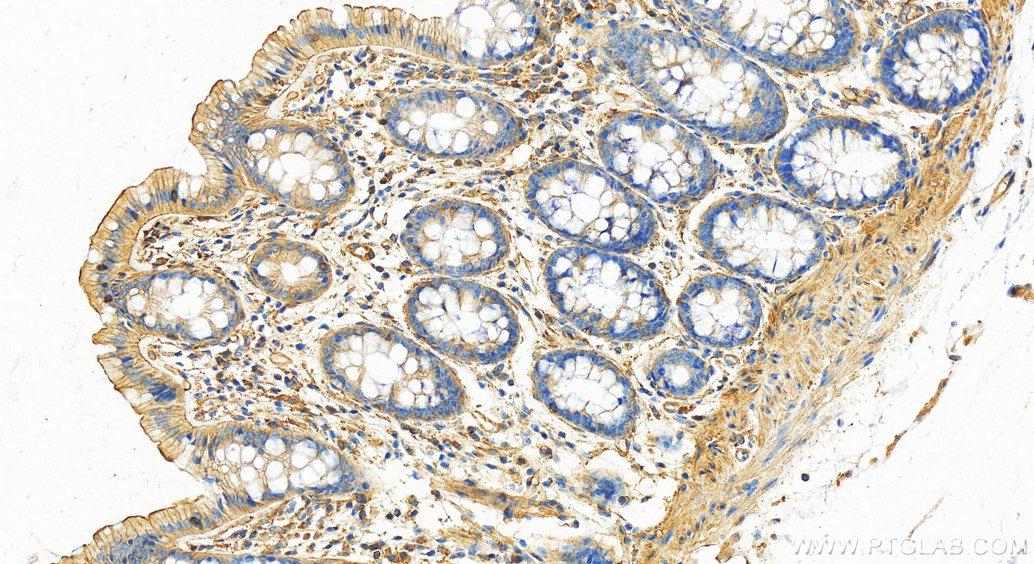 IHC staining of human colon using 14168-1-AP