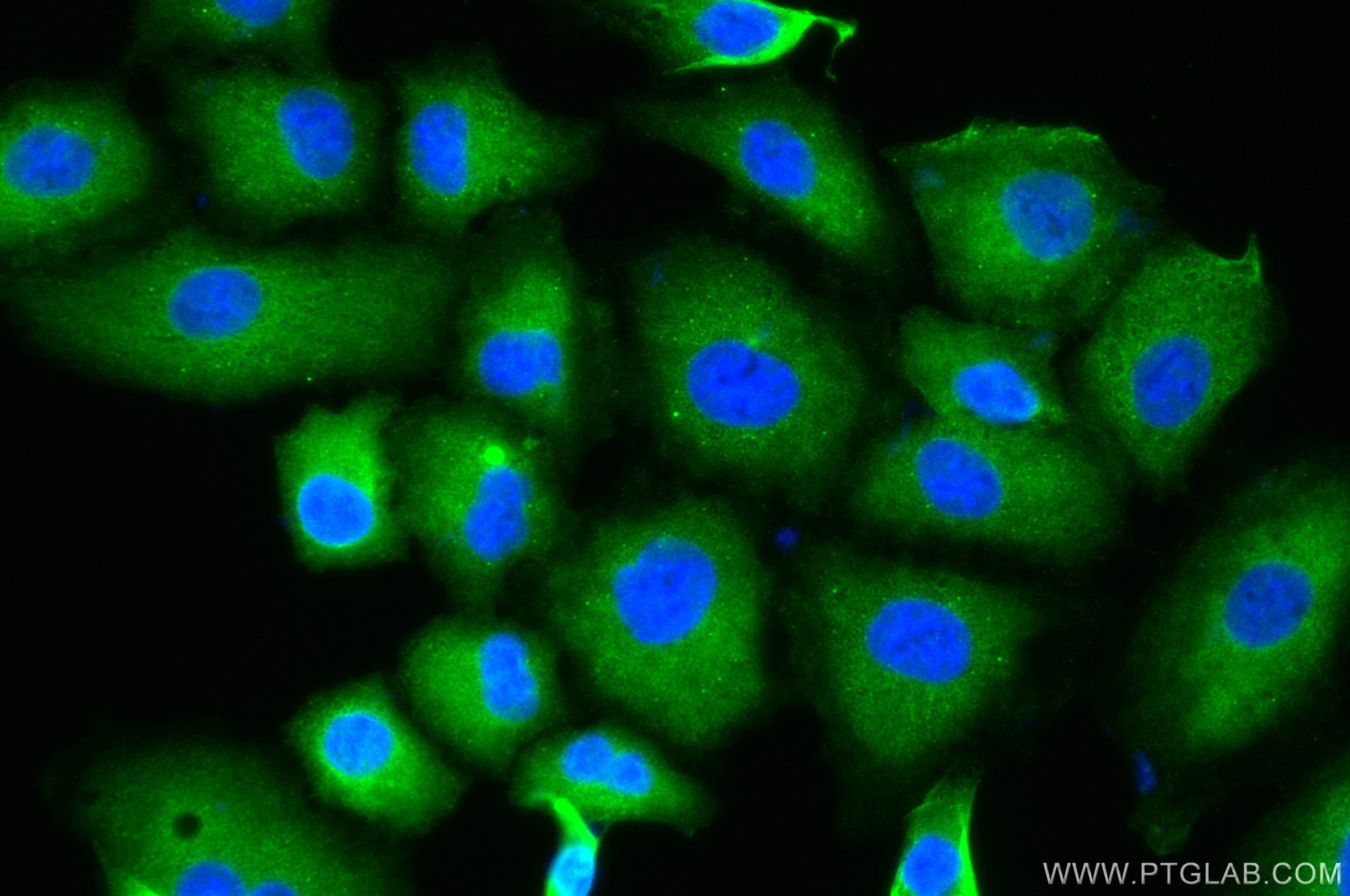 IF Staining of A549 using 67992-1-Ig