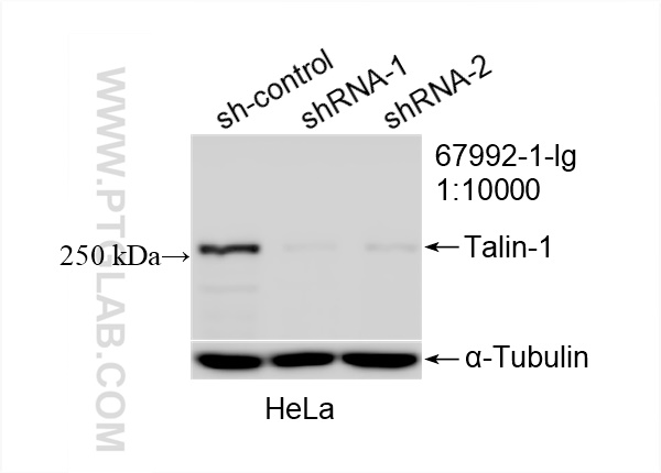 WB analysis of HeLa using 67992-1-Ig