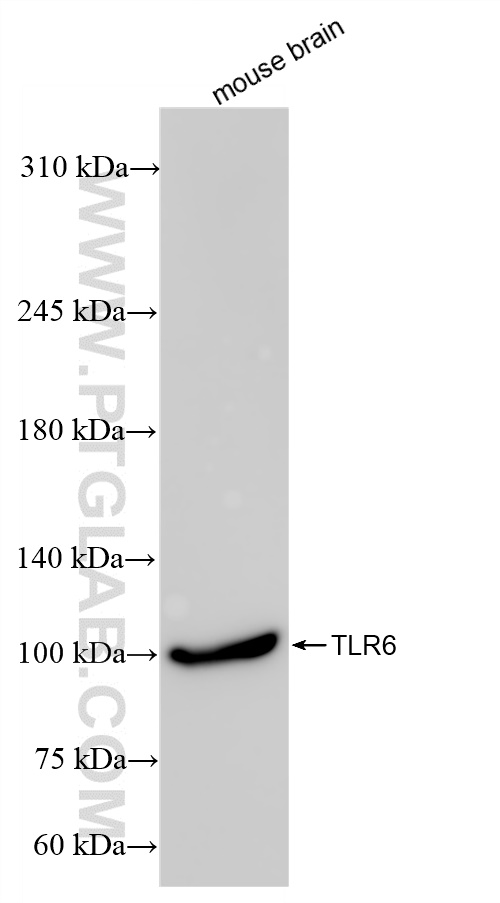 WB analysis of mouse brain using 84811-1-RR (same clone as 84811-1-PBS)