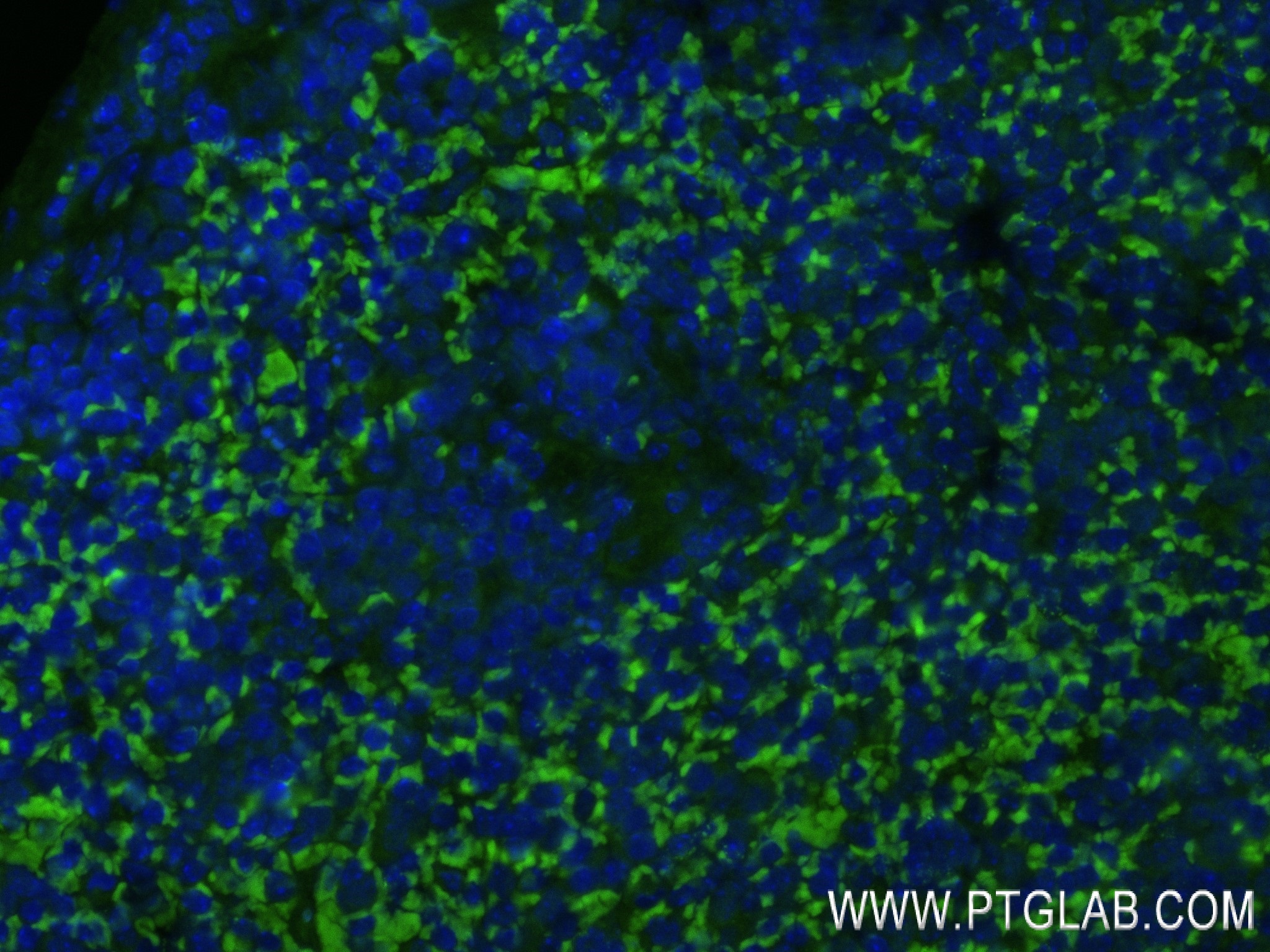 IF Staining of mouse spleen using 84811-2-RR (same clone as 84811-2-PBS)