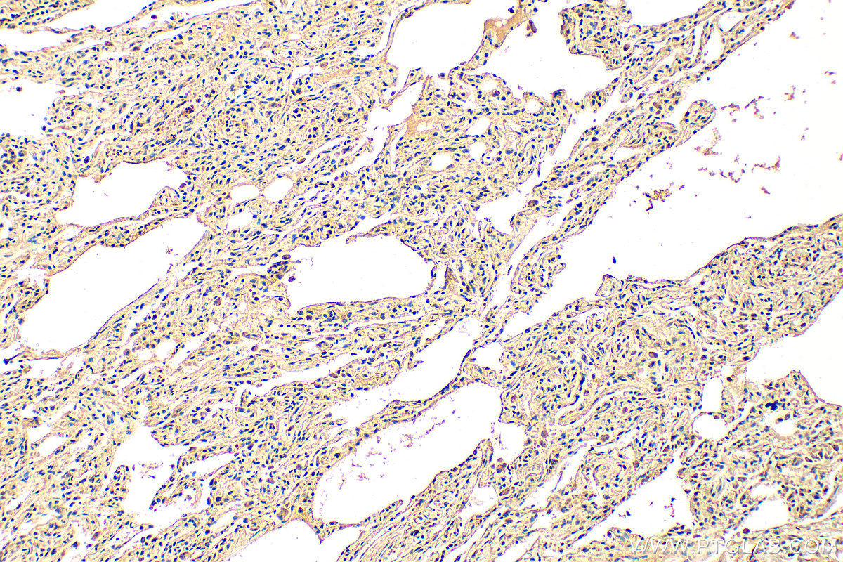 IHC staining of human lung using 17232-1-AP
