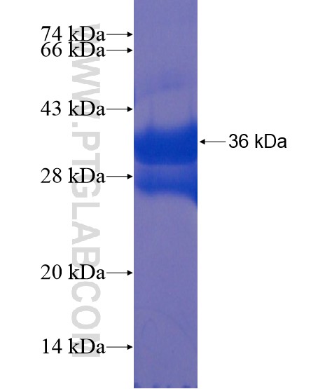 TLX1 fusion protein Ag21899 SDS-PAGE