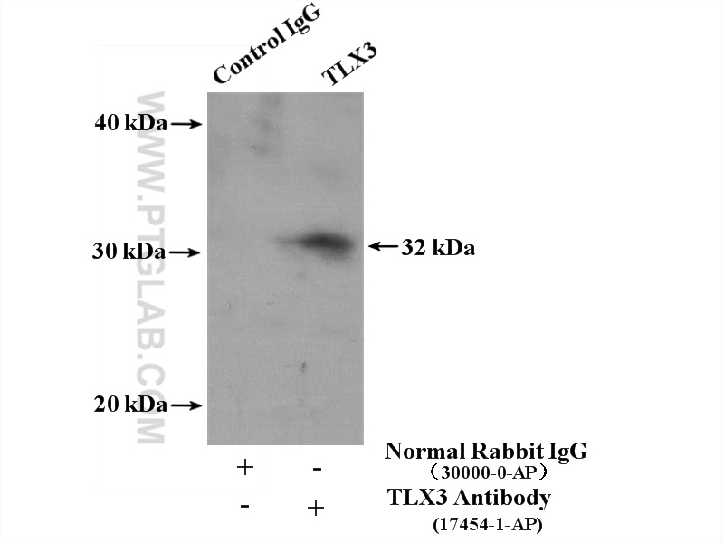 IP experiment of Jurkat using 17454-1-AP