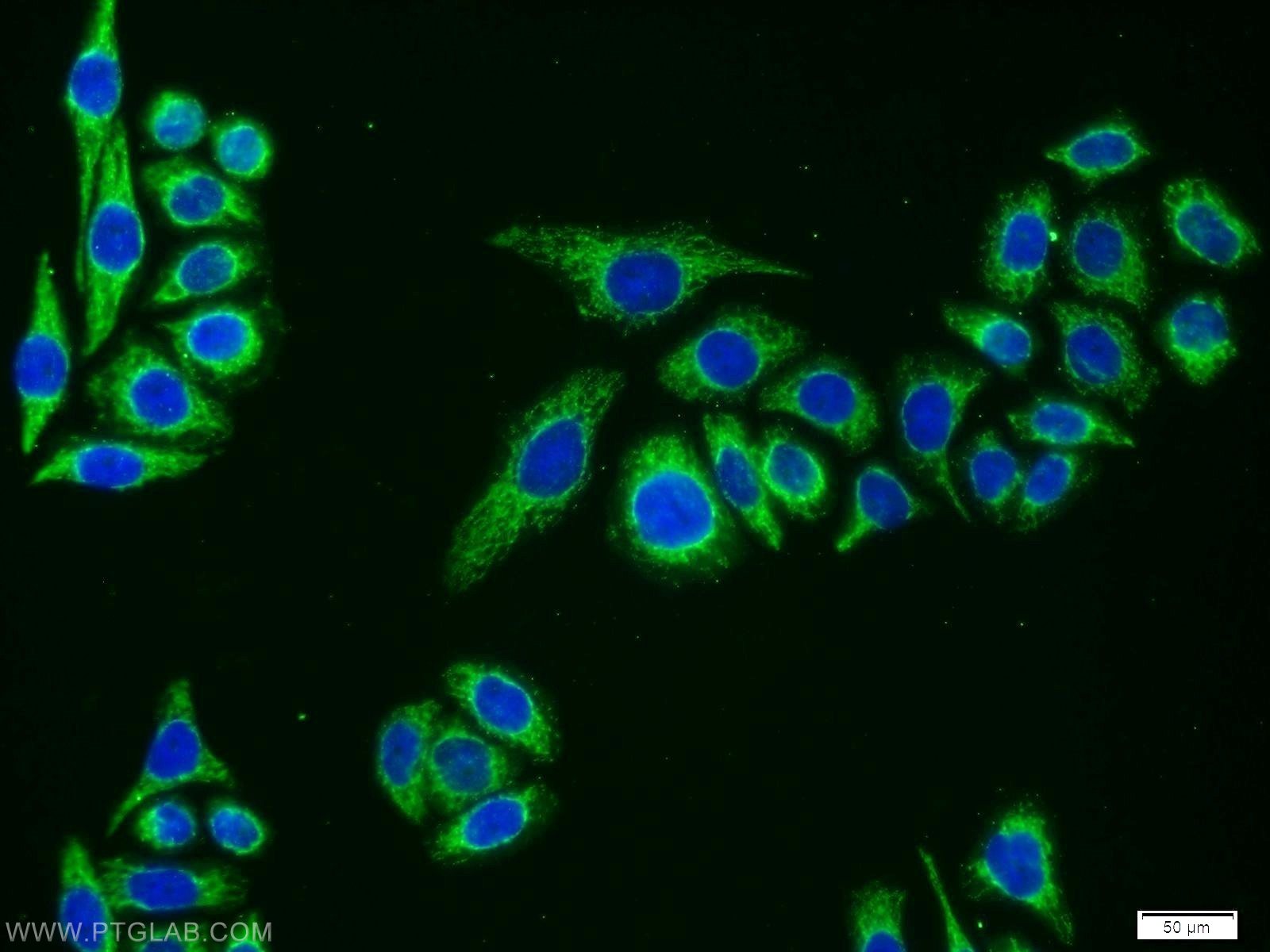 IF Staining of PC-3 using 12033-1-AP