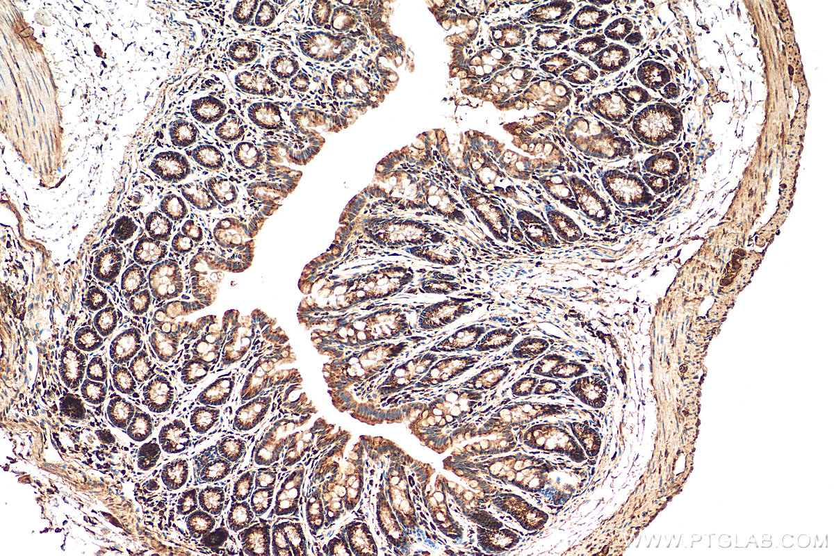 IHC staining of mouse colon using 29520-1-AP