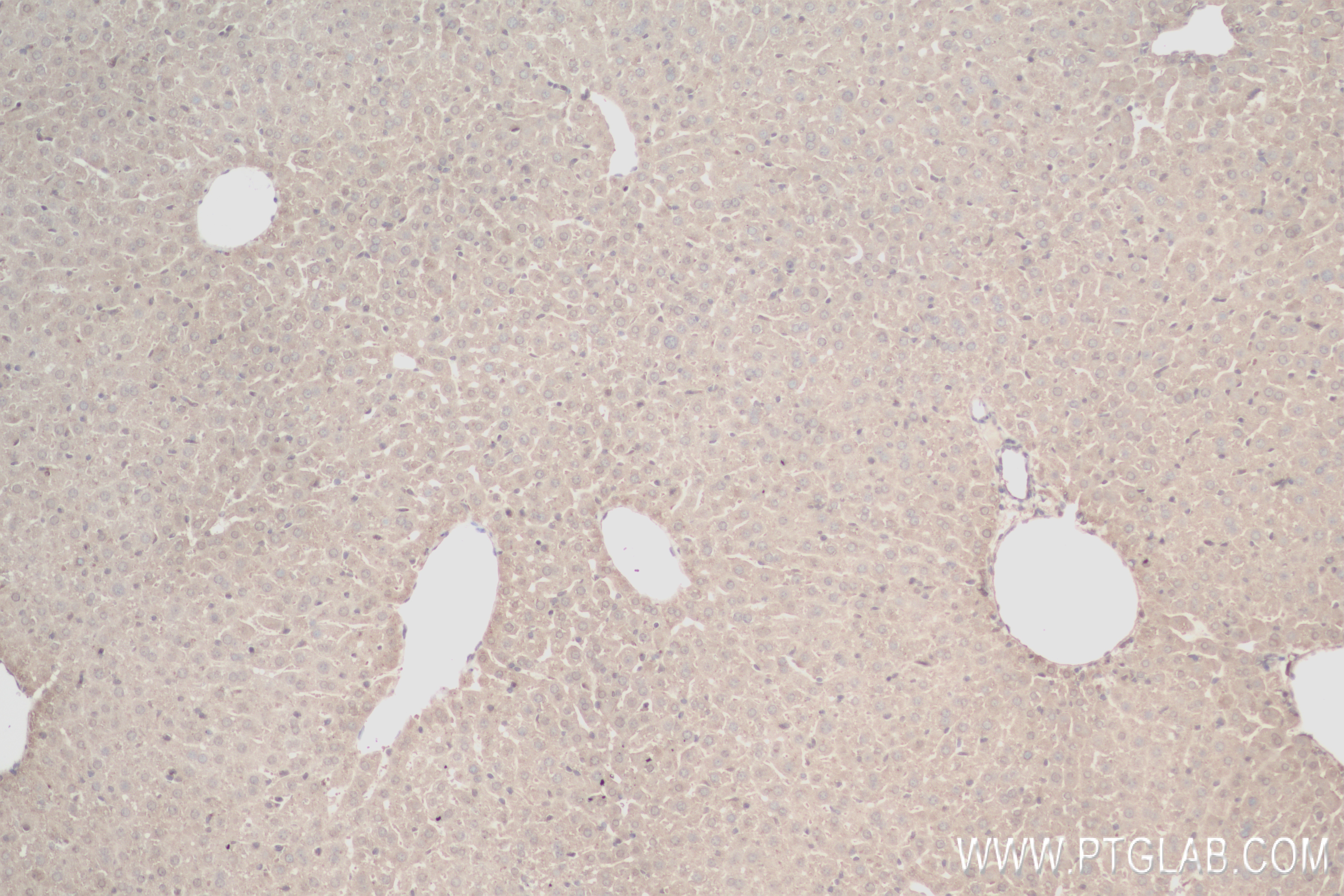 IHC staining of mouse liver using 84499-1-RR