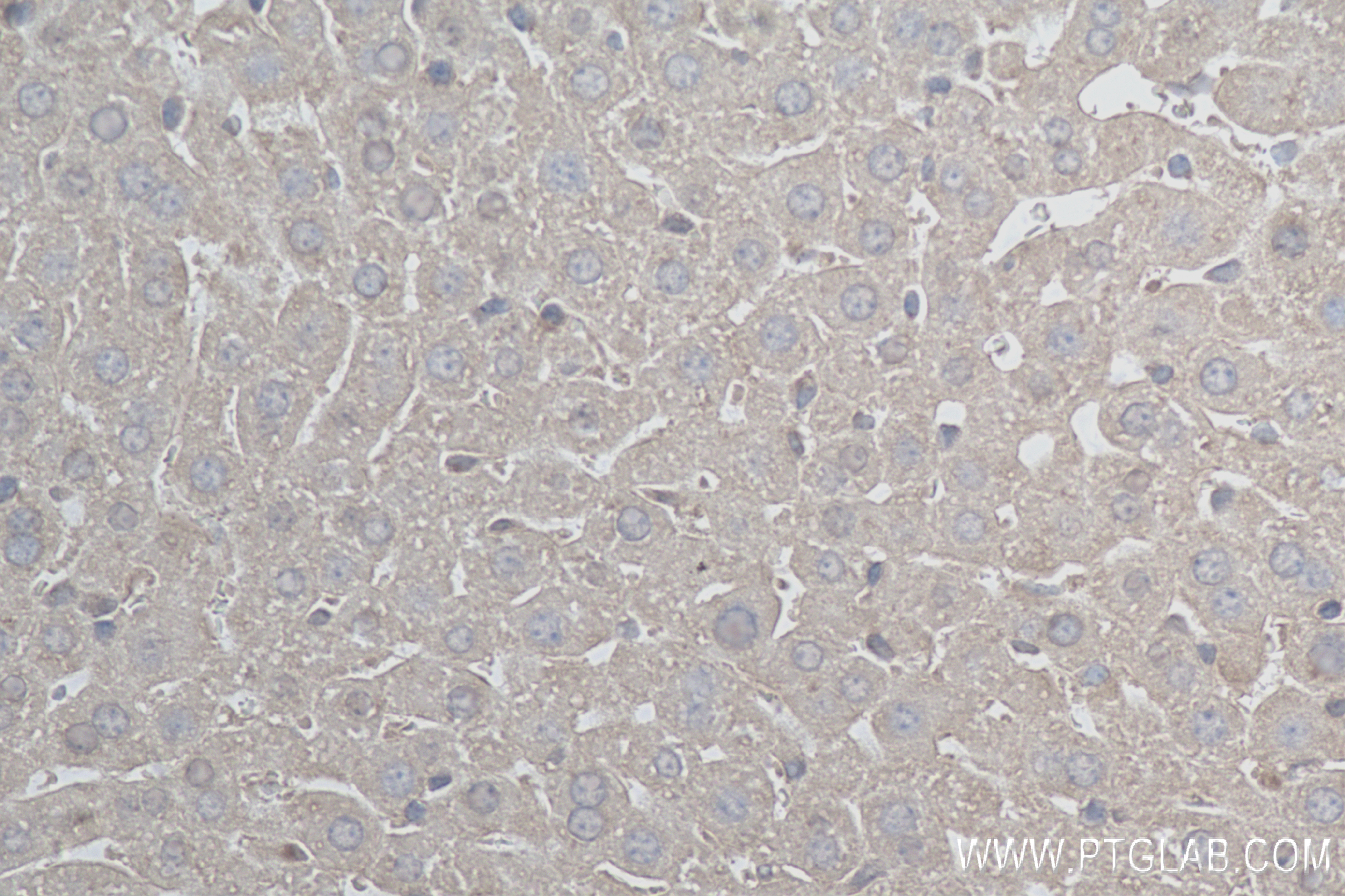 IHC staining of mouse liver using 84499-1-RR