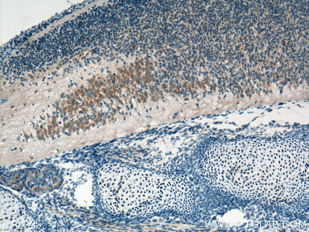 IHC staining of mouse embryo using 21099-1-AP