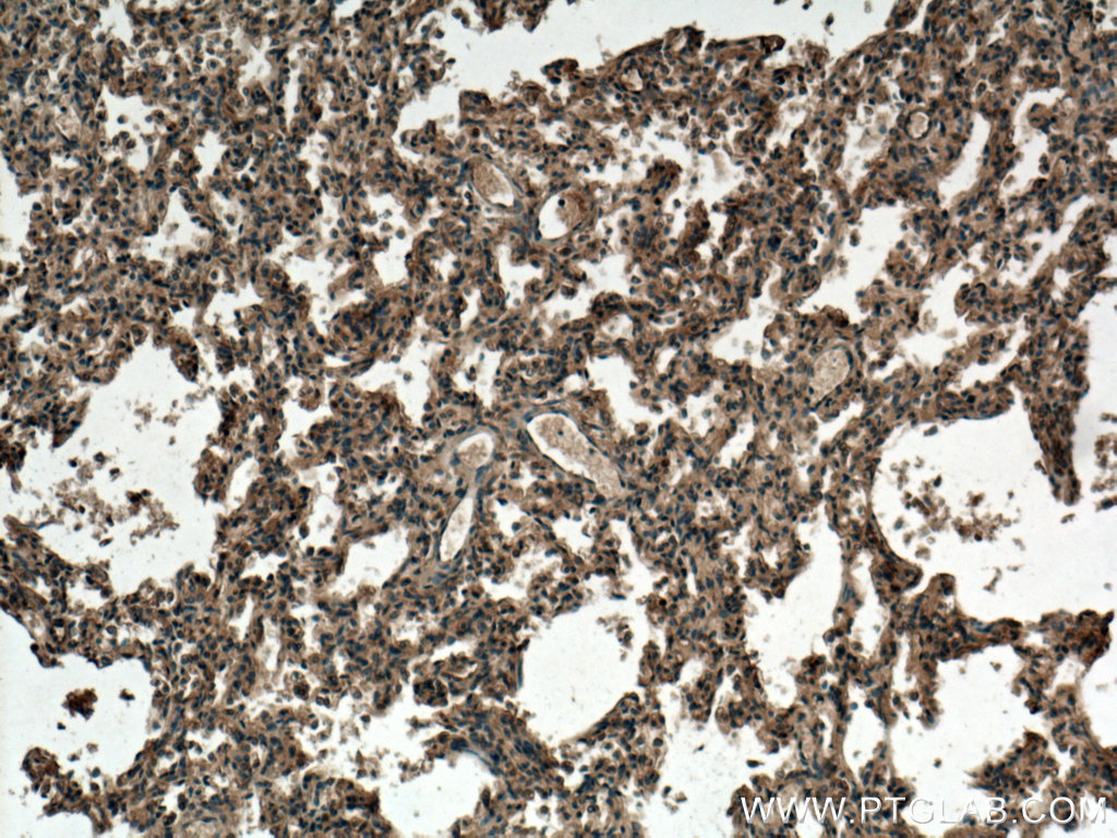 IHC staining of human lung using 25581-1-AP