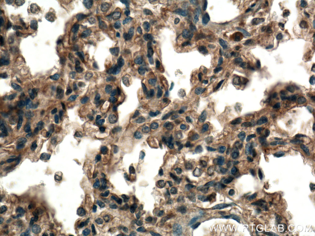 IHC staining of human lung using 25581-1-AP