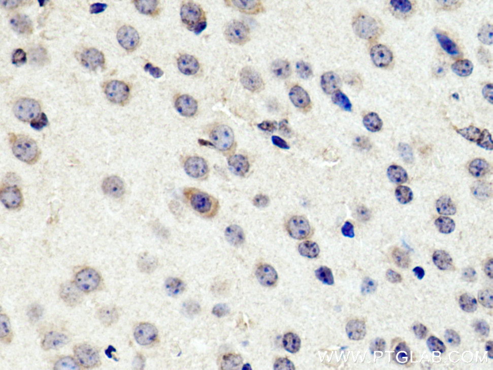 IHC staining of mouse brain using 25581-1-AP