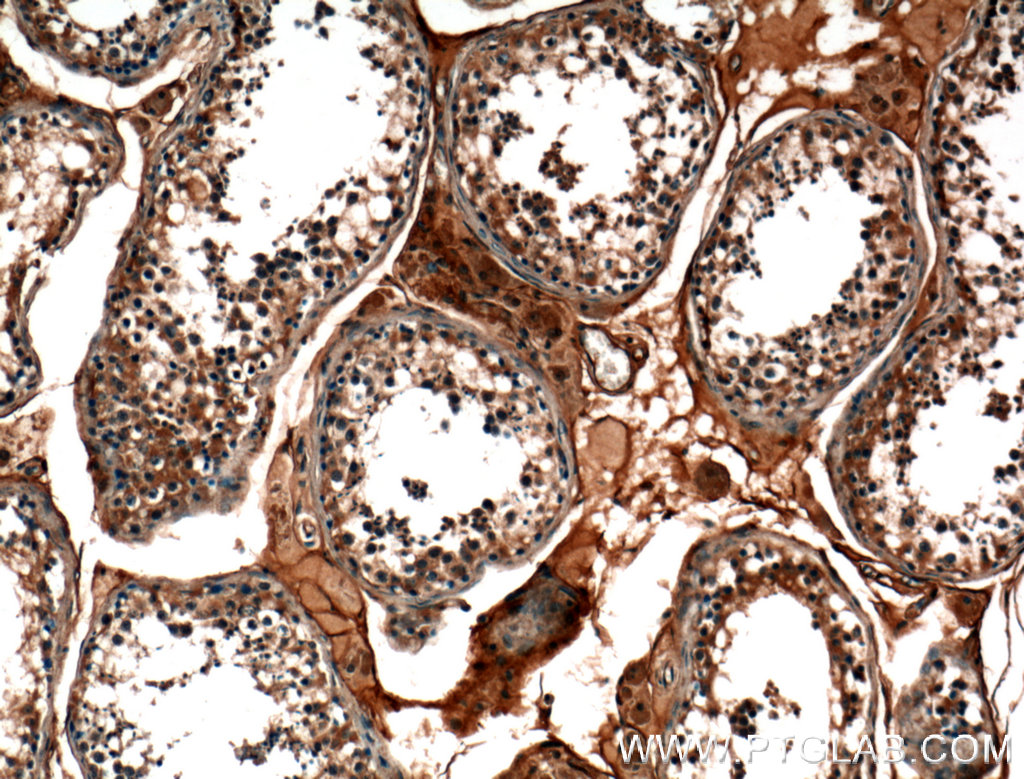 IHC staining of human testis using 25505-1-AP